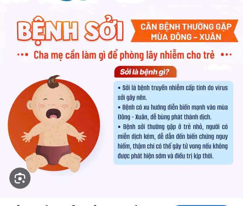 BỆNH SỞI NHỮNG ĐIỀU CẦN BIẾT